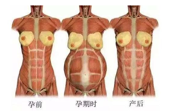 產(chǎn)后媽媽骨盆修復(fù)――帶你回到完美身材！