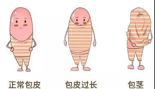 【保山安利醫(yī)院】家長(zhǎng)速看！暑期包皮手術(shù)預(yù)約正當(dāng)時(shí)！