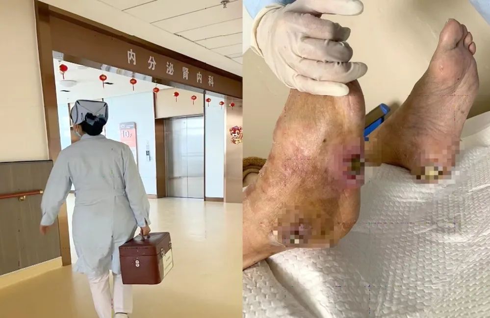 【保山安利醫(yī)院】傷口治療一站式，健康生活零距離！